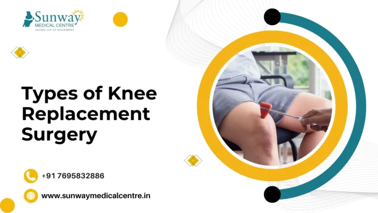 Types of Knee Replacement Surgery