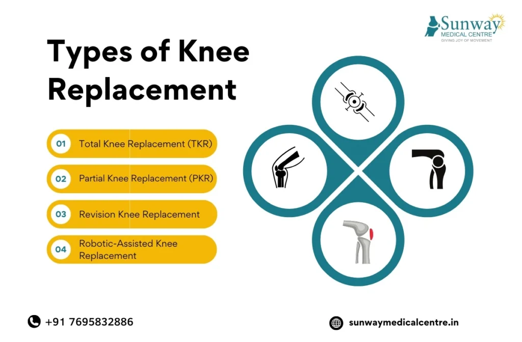 knee replacement surgery cost in chennai