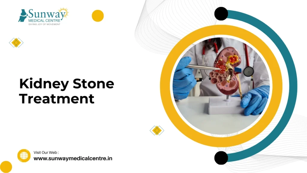 Kidney Stone Treatment