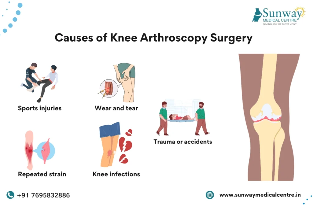 Knee Arthroscopy Recovery Time