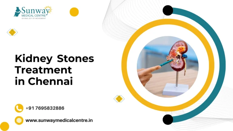 Kidney Stones Treatment in Chennai