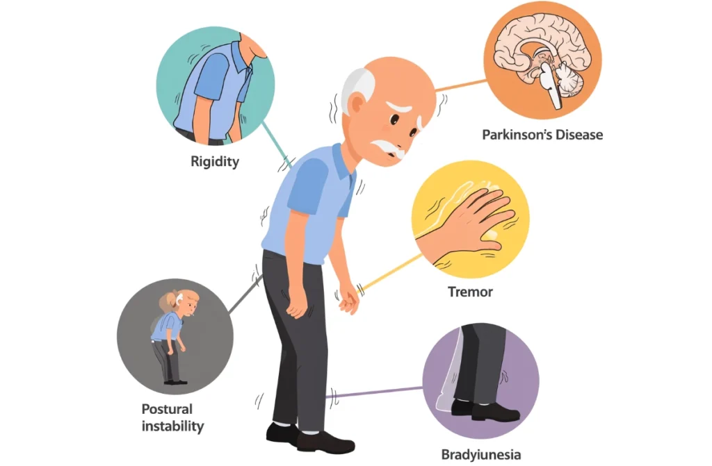 Parkinson’s Disease Treatment In Chennai
