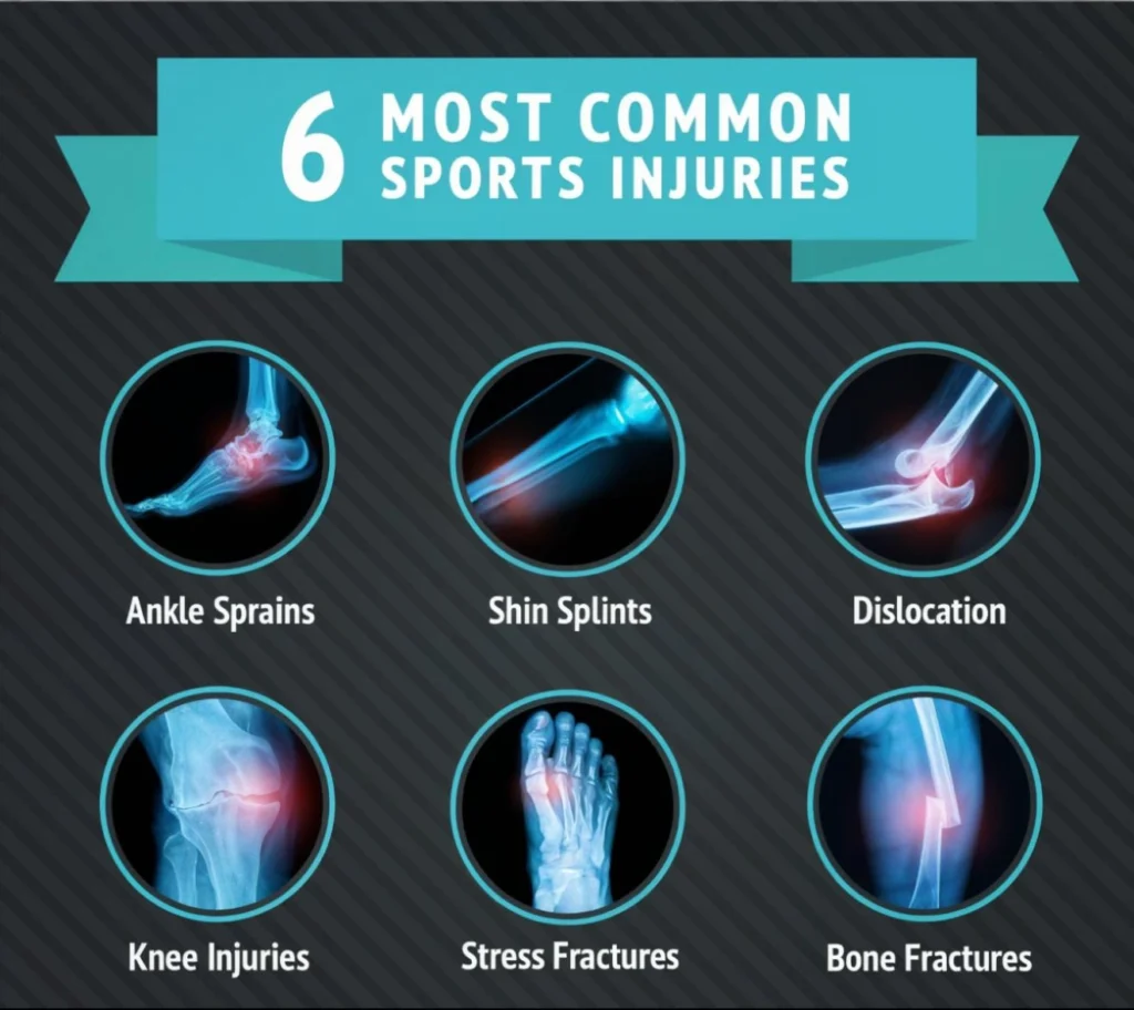 5 most common sports injuries