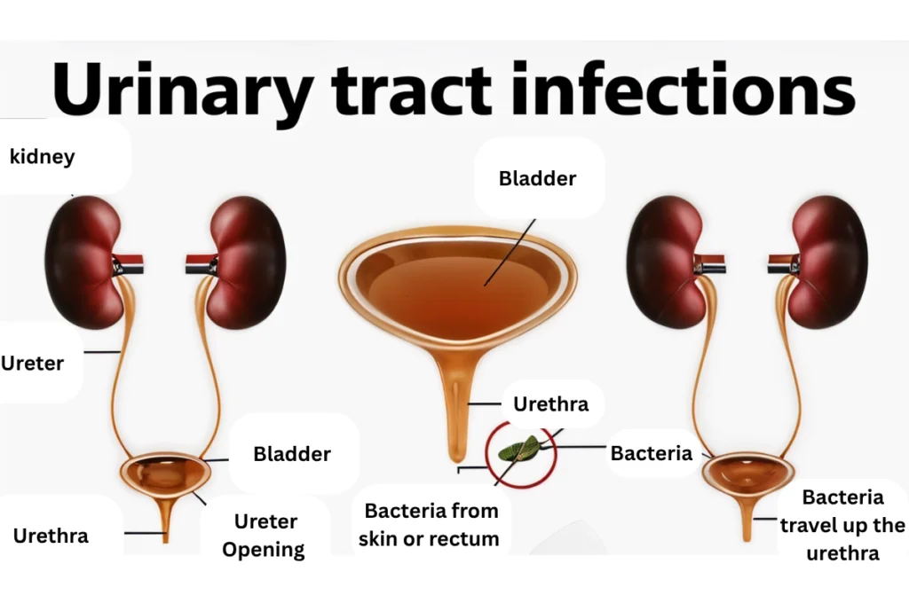 Best Urologist in Chennai