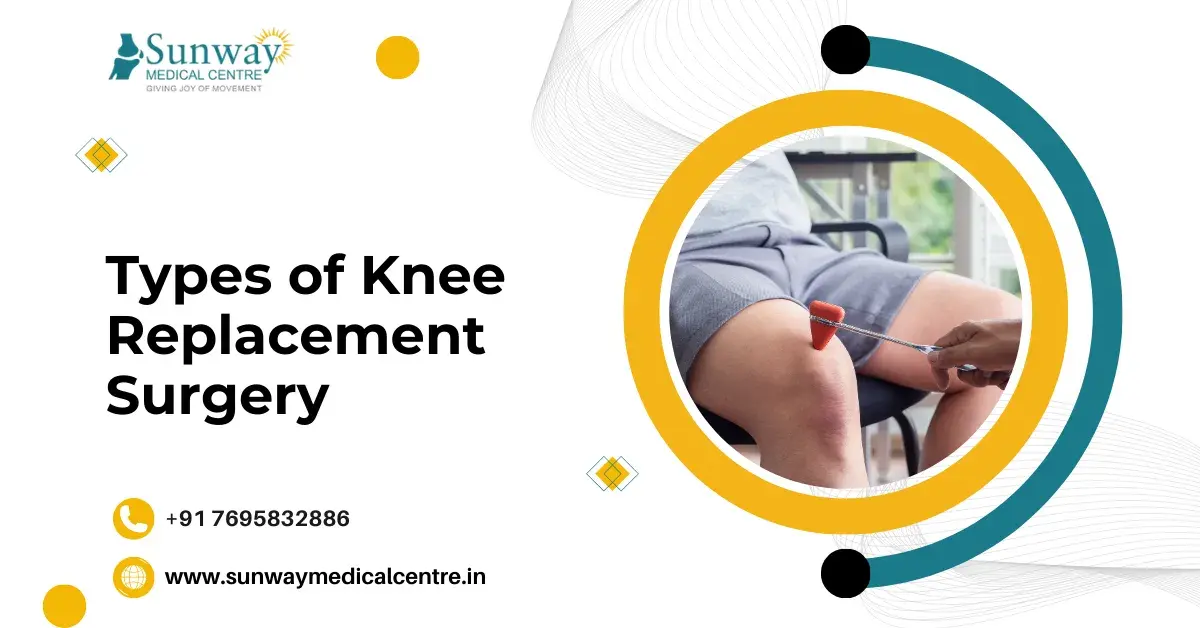 Types of Knee Replacement Surgery